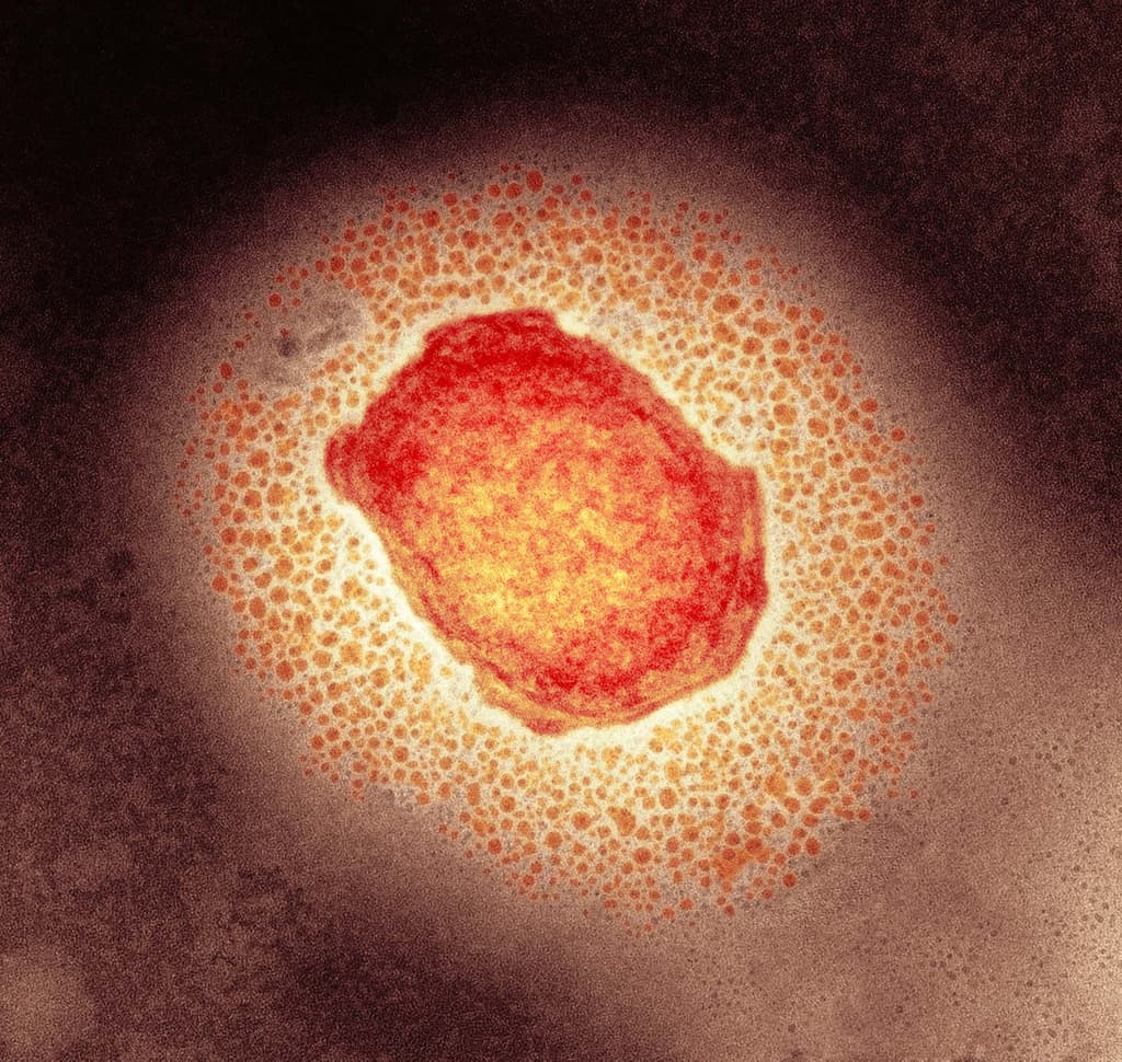 10+ monkeypox cases in US by October 31?