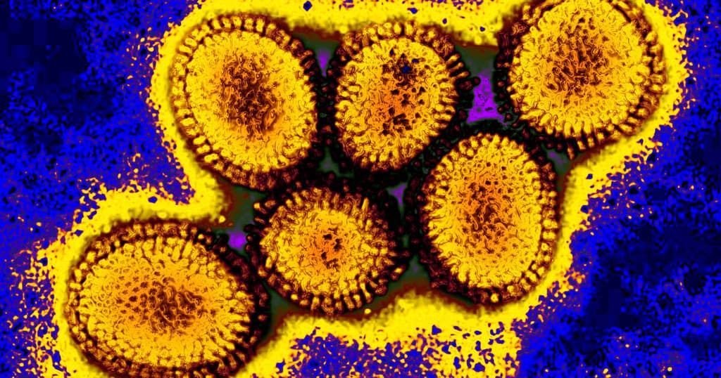 100+ Bird Flu cases in U.S. before February?